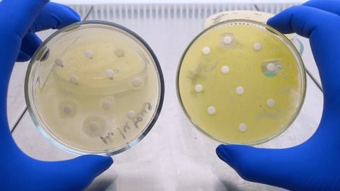 bacteria growth around antibiotic test discs, illustrating antimicrobial resistance